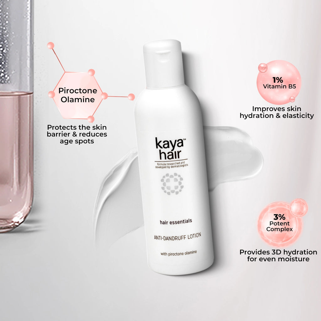 Anti Dandruff Lotion | Reducing Itchy Scalp Hair Solution 200 ml