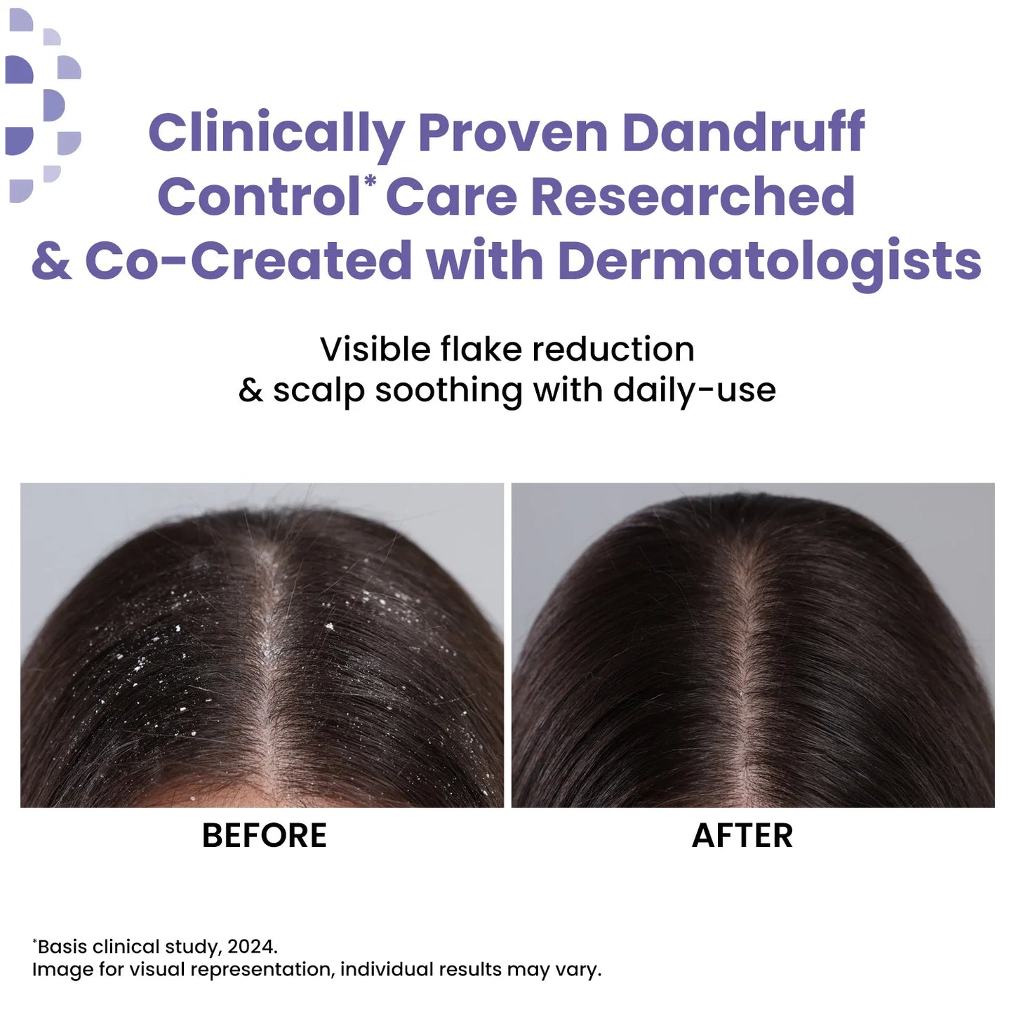 Anti Dandruff Shampoo | Clarifying & Hydrating Hair Shampoo 200 ml