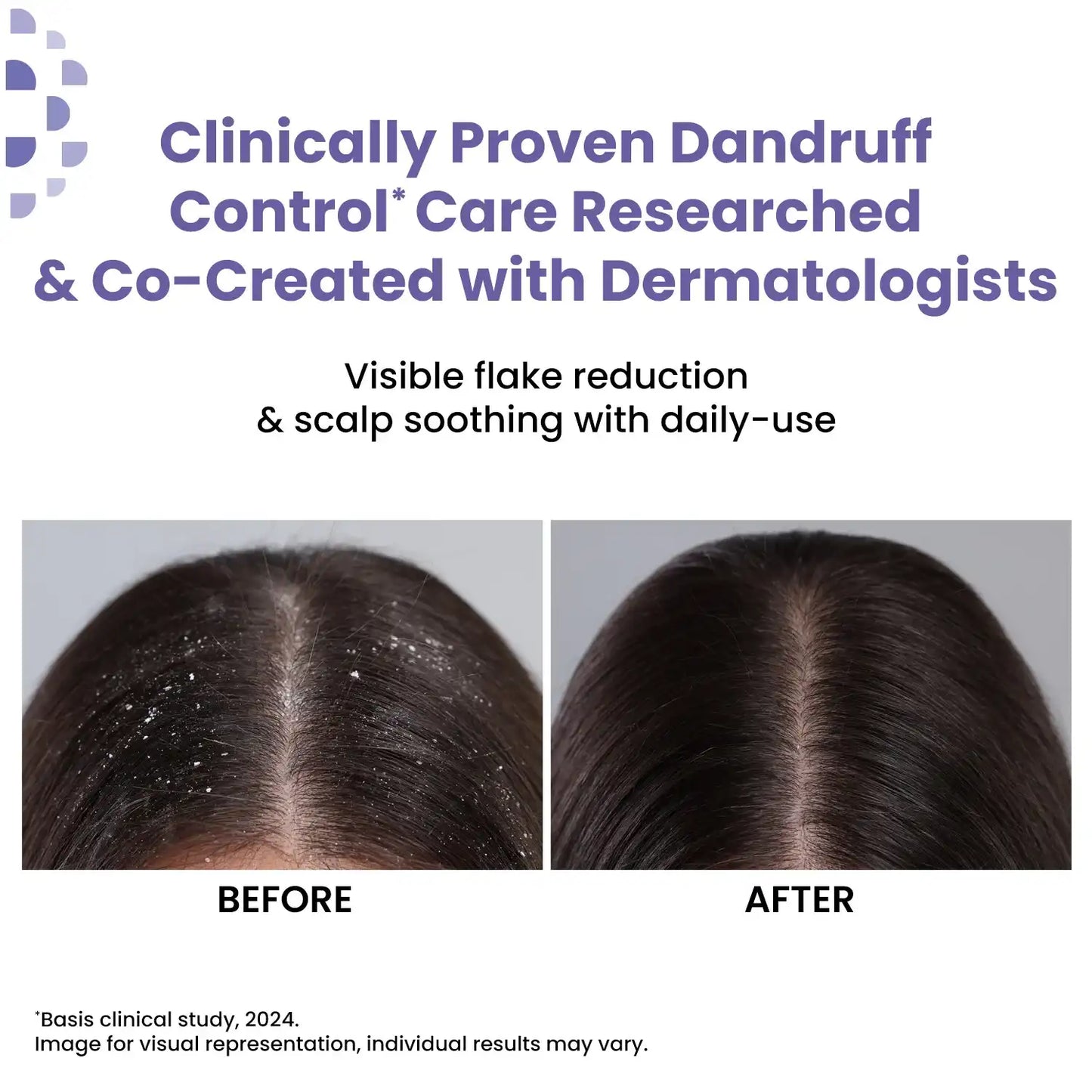 Anti Dandruff Shampoo | Clarifying & Hydrating Hair Shampoo 200 ml