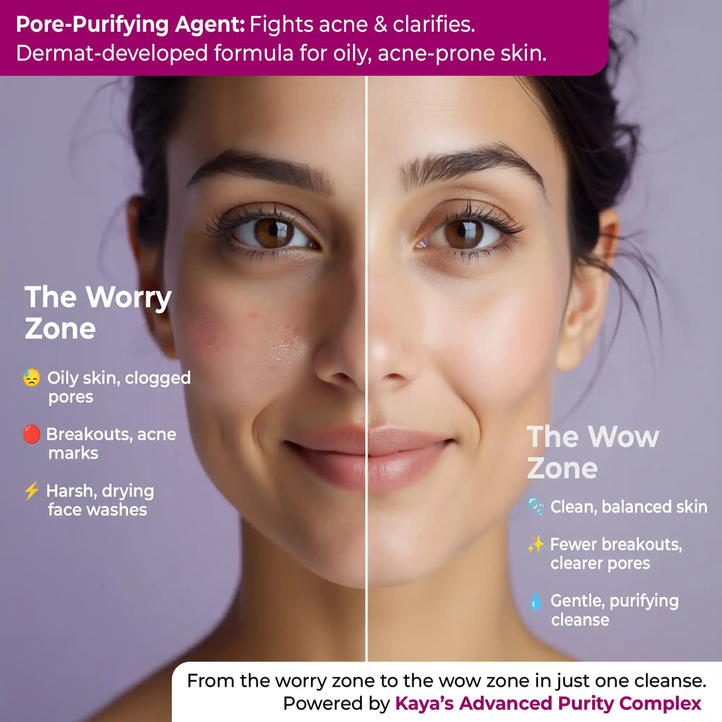 Salicylic Acid Purifying Cleanser | Acne Control Face Cleanser 100ml